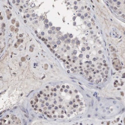 Invitrogen DKC1 Polyclonal Antibody:Antibodies:Primary Antibodies