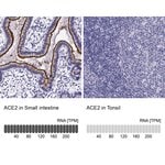 Thumbnail_ACE2 Polyclonal Antibody, Invitrogen 100 &mu;L; Unconjugated:Antibodies,