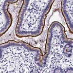Thumbnail_ACE2 Polyclonal Antibody, Invitrogen 100 &mu;L; Unconjugated:Antibodies,