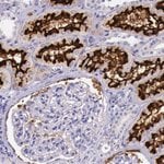 Thumbnail_ACE2 Polyclonal Antibody, Invitrogen 100 &mu;L; Unconjugated:Antibodies,