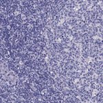 Thumbnail_ACE2 Polyclonal Antibody, Invitrogen 100 &mu;L; Unconjugated:Antibodies,