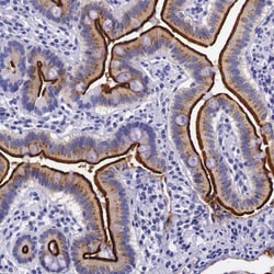 Invitrogen ACE2 Polyclonal Antibody 100 &mu;L; Unconjugated:Anticuerpos