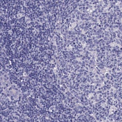 Invitrogen ACE2 Polyclonal Antibody 100 &mu;L; Unconjugated:Anticuerpos