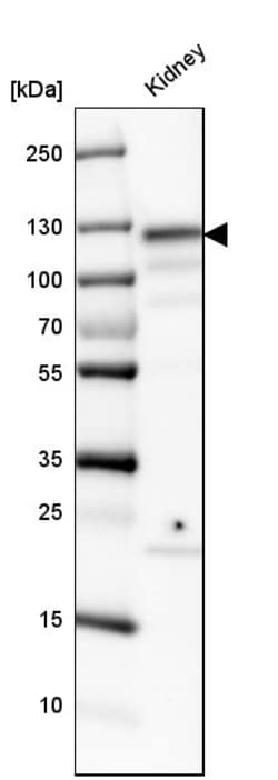 Invitrogen ACE2 Polyclonal Antibody 100 &mu;L; Unconjugated:Anticuerpos