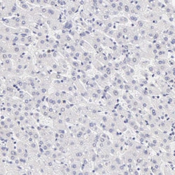 Invitrogen Cytokeratin 17 Polyclonal Antibody 100 &mu;L; Unconjugated:Antibodies,