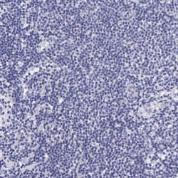 Invitrogen Cytokeratin 17 Polyclonal Antibody 100 &mu;L; Unconjugated:Antibodies,