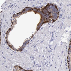 Invitrogen Cytokeratin 17 Polyclonal Antibody 100 &mu;L; Unconjugated:Antibodies,