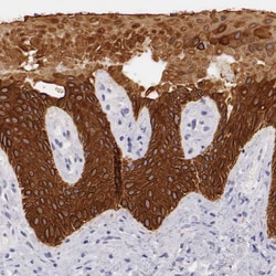 Invitrogen Cytokeratin 17 Polyclonal Antibody 100 &mu;L; Unconjugated:Antibodies,