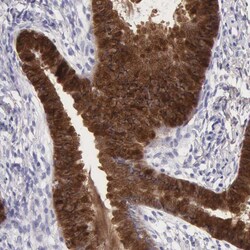 Invitrogen Apolipoprotein J Polyclonal Antibody 100 &mu;L | Buy Online | Invitrogen&trade; | Fisher Scientific