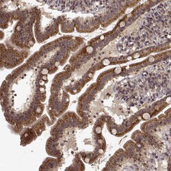 Invitrogen TRMU Polyclonal Antibody 100 &mu;L; Unconjugated:Antibodies,