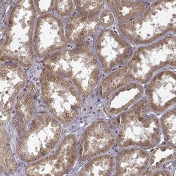 Invitrogen TRMU Polyclonal Antibody 100 &mu;L; Unconjugated:Antibodies,