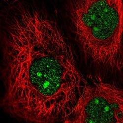 Invitrogen MLK1 Polyclonal Antibody 100 &mu;L; Unconjugated:Antibodies,