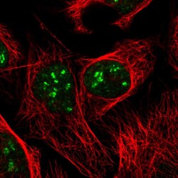 Invitrogen DKC1 Polyclonal Antibody 100 &mu;L; Unconjugated:Antibodies,
