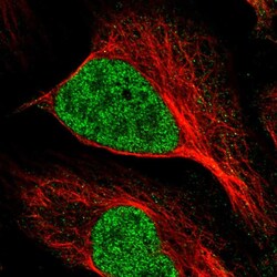 Invitrogen MNAT1 Polyclonal Antibody 100 &mu;L; Unconjugated:Antibodies,