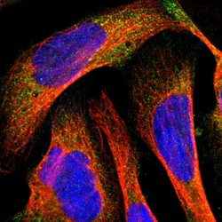 Invitrogen MMP9 Polyclonal Antibody 100 &mu;L; Unconjugated:Antibodies,