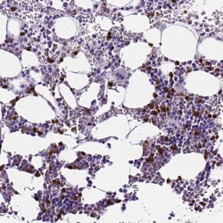 Invitrogen MMP9 Polyclonal Antibody 100 &mu;L; Unconjugated:Antibodies,