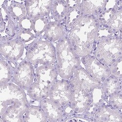 Invitrogen MMP9 Polyclonal Antibody 100 &mu;L; Unconjugated:Antibodies,