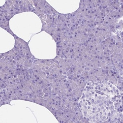 Invitrogen MMP9 Polyclonal Antibody 100 &mu;L; Unconjugated:Antibodies,