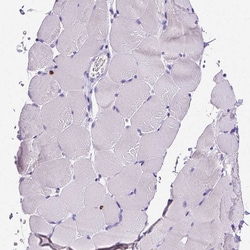 Invitrogen MMP9 Polyclonal Antibody 100 &mu;L; Unconjugated:Antibodies,
