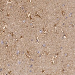 Invitrogen Creatine Kinase BB Polyclonal Antibody 100 μL; Unconjugated:Antibodies,