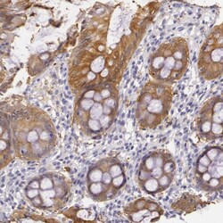 Invitrogen Creatine Kinase BB Polyclonal Antibody 100 μL; Unconjugated:Antibodies,