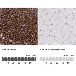 Invitrogen Syk Polyclonal Antibody 100 &mu;L; Unconjugated:Antibodies,