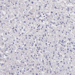 Invitrogen Factor XIII A Polyclonal Antibody 100 μL; Unconjugated:Antibodies,
