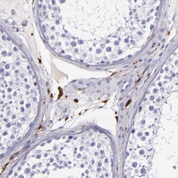 Invitrogen Factor XIII A Polyclonal Antibody 100 μL; Unconjugated:Antibodies,