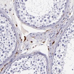 Factor XIII A Polyclonal Antibody, Invitrogen 100 &mu;L; Unconjugated:Antibodies,