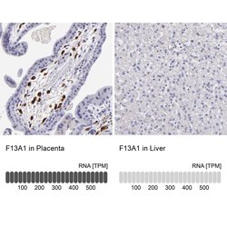 Factor XIII A Polyclonal Antibody, Invitrogen 100 &mu;L; Unconjugated:Antibodies,