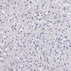 Factor XIII A Polyclonal Antibody, Invitrogen 100 &mu;L; Unconjugated:Antibodies,