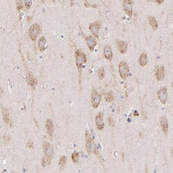 Invitrogen PREX1 Polyclonal Antibody 100 &mu;L | Buy Online | Invitrogen&trade; | Fisher Scientific