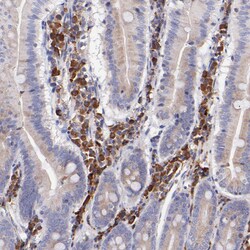 Invitrogen PREX1 Polyclonal Antibody 100 &mu;L | Buy Online | Invitrogen&trade; | Fisher Scientific