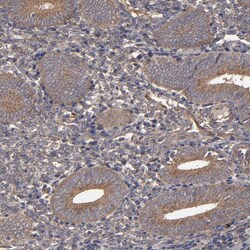 Invitrogen MMP2 Polyclonal Antibody 100 &mu;L; Unconjugated:Antibodies,