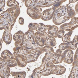 Invitrogen MMP2 Polyclonal Antibody 100 &mu;L; Unconjugated:Antibodies,