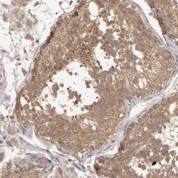 Invitrogen MMP2 Polyclonal Antibody 100 &mu;L; Unconjugated:Antibodies,