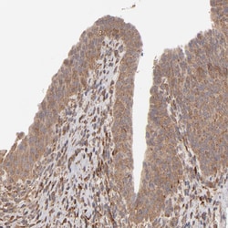 Invitrogen MMP2 Polyclonal Antibody 100 &mu;L; Unconjugated:Antibodies,