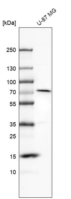 Invitrogen MMP2 Polyclonal Antibody 100 &mu;L | Buy Online | Invitrogen&trade; | Fisher Scientific