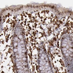 Invitrogen WASP Polyclonal Antibody 100 μL; Unconjugated:Antibodies,
