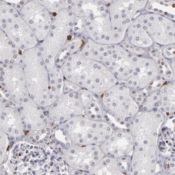 Invitrogen WASP Polyclonal Antibody 100 μL; Unconjugated:Antibodies,