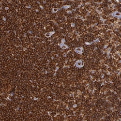 Invitrogen WASP Polyclonal Antibody 100 μL; Unconjugated:Antibodies,