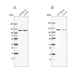 Invitrogen LONP1 Polyclonal Antibody 100 &mu;L | Buy Online | Invitrogen&trade; | Fisher Scientific
