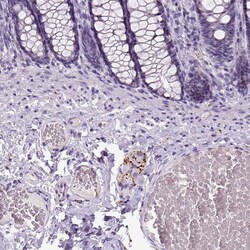 Invitrogen Dopamine beta Hydroxylase Polyclonal Antibody 100 &mu;L; Unconjugated:Antibodies,