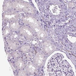 Invitrogen Dopamine beta Hydroxylase Polyclonal Antibody 100 &mu;L; Unconjugated:Antibodies,