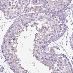 Invitrogen Dopamine beta Hydroxylase Polyclonal Antibody 100 &mu;L; Unconjugated:Antibodies,