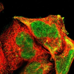 Invitrogen Aurora A Polyclonal Antibody 100 μL; Unconjugated:Antibodies,