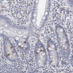Invitrogen Aurora A Polyclonal Antibody 100 μL; Unconjugated:Antibodies,