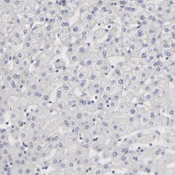 Invitrogen Aurora A Polyclonal Antibody 100 μL; Unconjugated:Antibodies,