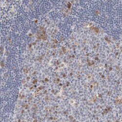 Invitrogen Aurora A Polyclonal Antibody 100 μL; Unconjugated:Antibodies,