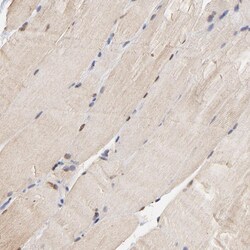Invitrogen Survivin Polyclonal Antibody 100 μL; Unconjugated:Antibodies,